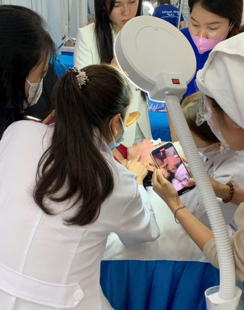 Liệu Trình Nám - Tàn Nhang