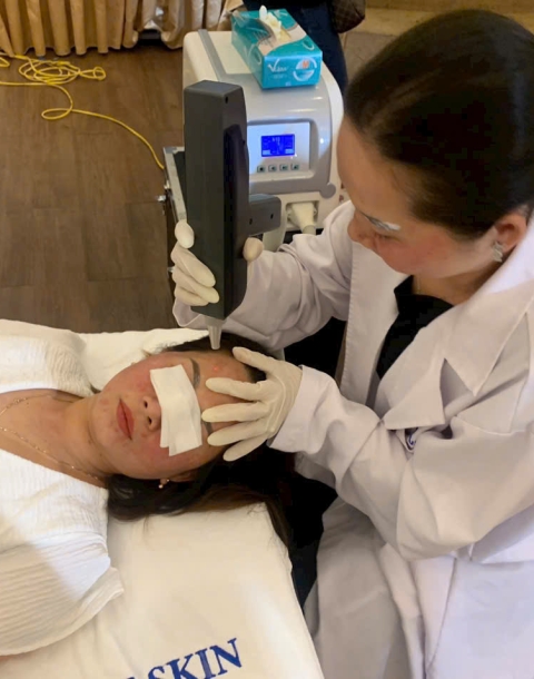 Sau lăn kim bao lâu da trở lại bình thường? Các câu hỏi liên quan